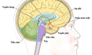 Chữa và điều trị ung thư não như thế nào?